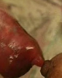 photo-thumb