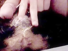 Thumb 20