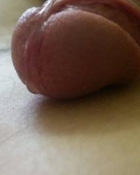photo-thumb