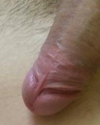 photo-thumb