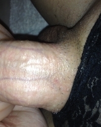 photo-thumb