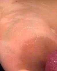 photo-thumb
