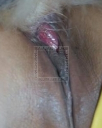 photo-thumb